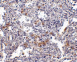 Invitrogen TMC6 Polyclonal Antibody 100 &mu;g; Unconjugated:Antibodies,