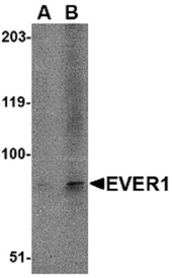 Invitrogen TMC6 Polyclonal Antibody 100 &mu;g; Unconjugated:Antibodies,