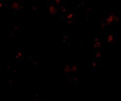 Invitrogen TMC6 Polyclonal Antibody 100 &mu;g | Buy Online | Invitrogen&trade; | Fisher Scientific