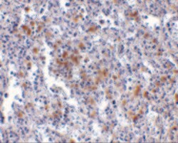 Invitrogen TMC6 Polyclonal Antibody 100 &mu;g | Buy Online | Invitrogen&trade; | Fisher Scientific