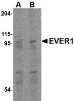 Invitrogen TMC6 Polyclonal Antibody 100 &mu;g | Buy Online | Invitrogen&trade; | Fisher Scientific