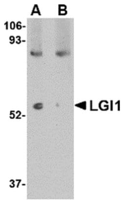 Invitrogen LGI1 Polyclonal Antibody 100 &mu;g; Unconjugated:Antibodies,