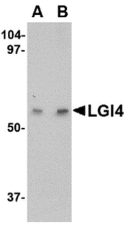 Invitrogen LGI4 Polyclonal Antibody 100 &mu;g | Buy Online | Invitrogen&trade; | Fisher Scientific