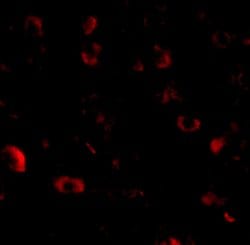 Invitrogen CAPS1 Polyclonal Antibody 100 &mu;g | Buy Online | Invitrogen&trade; | Fisher Scientific