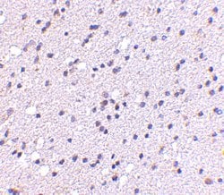 Invitrogen CADPS2 Polyclonal Antibody 100 &mu;g; Unconjugated:Antibodies,