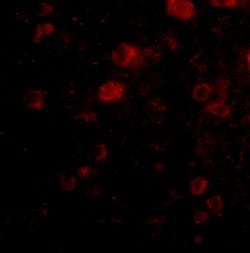 Invitrogen VGF Polyclonal Antibody 100 &mu;g; Unconjugated:Antibodies,