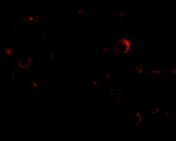 Invitrogen EVER2 Polyclonal Antibody 100 &mu;g | Buy Online | Invitrogen&trade; | Fisher Scientific