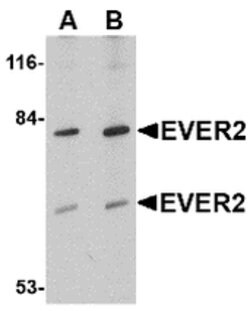 Invitrogen EVER2 Polyclonal Antibody 100 &mu;g | Buy Online | Invitrogen&trade; | Fisher Scientific