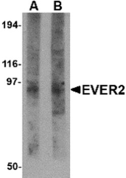 Invitrogen EVER2 Polyclonal Antibody 100 &mu;g; Unconjugated:Antibodies,