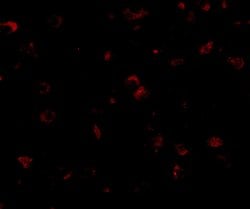 Invitrogen SAPAP1 Polyclonal Antibody 100 &mu;g; Unconjugated:Antibodies,