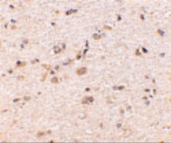 Invitrogen SAPAP1 Polyclonal Antibody 100 &mu;g; Unconjugated:Antibodies,