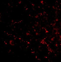 Invitrogen SATB2 Polyclonal Antibody 100 &mu;g | Buy Online | Invitrogen&trade; | Fisher Scientific