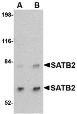 Invitrogen SATB2 Polyclonal Antibody 100 &mu;g | Buy Online | Invitrogen&trade; | Fisher Scientific