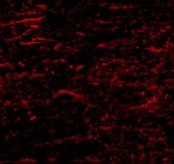 SATB1 Polyclonal Antibody, Invitrogen 100 &mu;g; Unconjugated:Antibodies