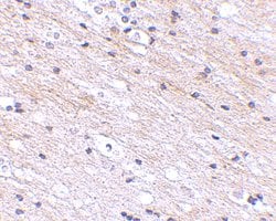 SATB1 Polyclonal Antibody, Invitrogen 100 &mu;g; Unconjugated:Antibodies