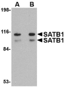 SATB1 Polyclonal Antibody, Invitrogen 100 &mu;g; Unconjugated:Antibodies