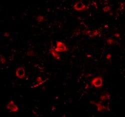 Invitrogen NANOS3 Polyclonal Antibody 100 &mu;g; Unconjugated:Antibodies,
