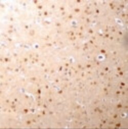 Invitrogen NANOS3 Polyclonal Antibody 100 &mu;g; Unconjugated:Antibodies,
