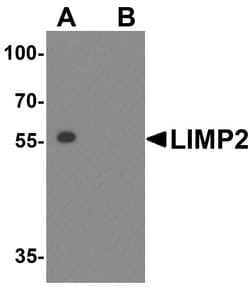 Invitrogen LIMP2 Polyclonal Antibody 100 μg; Unconjugated:Antibodies,