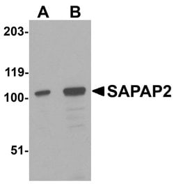 Invitrogen SAPAP2 Polyclonal Antibody 100 &mu;g; Unconjugated:Antibodies,