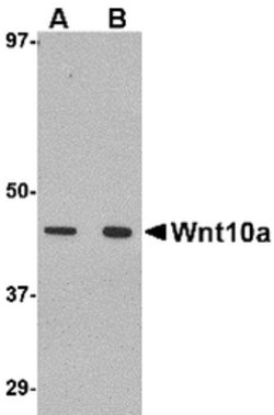 Invitrogen WNT10A Polyclonal Antibody 100 &mu;g | Buy Online | Invitrogen&trade; | Fisher Scientific