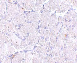 Invitrogen LIMP2 Polyclonal Antibody 100 &mu;g; Unconjugated:Antibodies