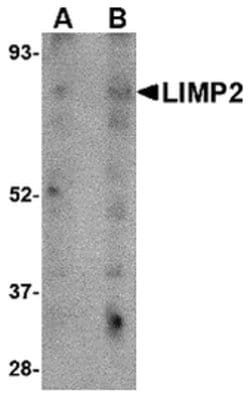 Invitrogen LIMP2 Polyclonal Antibody 100 &mu;g; Unconjugated:Antibodies