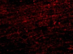 Invitrogen CLIP1 Polyclonal Antibody 100 &mu;g | Buy Online | Invitrogen&trade; | Fisher Scientific