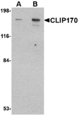 Invitrogen CLIP1 Polyclonal Antibody 100 &mu;g | Buy Online | Invitrogen&trade; | Fisher Scientific