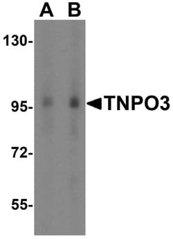 Invitrogen TNPO3 Polyclonal Antibody 100 &mu;g; Unconjugated:Antibodies