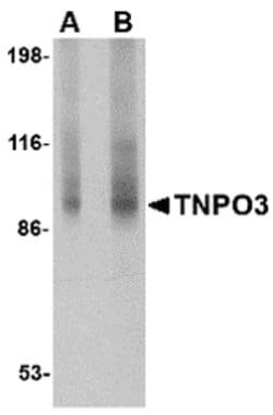 Invitrogen TNPO3 Polyclonal Antibody 100 &mu;g; Unconjugated:Antibodies