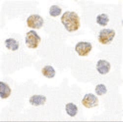 Invitrogen SLC35D1 Polyclonal Antibody 100 &mu;g; Unconjugated:Antibodies,