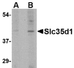 Invitrogen SLC35D1 Polyclonal Antibody 100 &mu;g; Unconjugated:Antibodies,