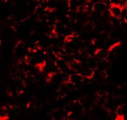 Invitrogen NANOS2 Polyclonal Antibody 100 &mu;g | Buy Online | Invitrogen&trade; | Fisher Scientific