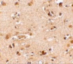 Invitrogen NANOS2 Polyclonal Antibody 100 &mu;g | Buy Online | Invitrogen&trade; | Fisher Scientific