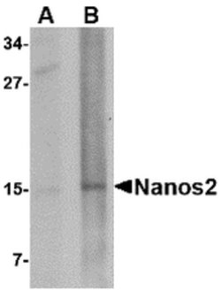 Invitrogen NANOS2 Polyclonal Antibody 100 &mu;g | Buy Online | Invitrogen&trade; | Fisher Scientific