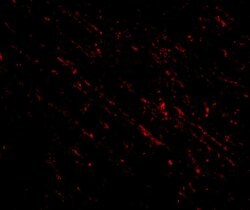 Invitrogen NANOS1 Polyclonal Antibody 100 μg; Unconjugated:Antibodies,