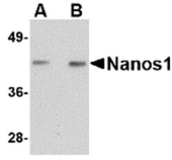 Invitrogen NANOS1 Polyclonal Antibody 100 μg; Unconjugated:Antibodies,