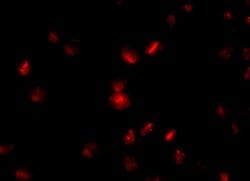 Invitrogen NUP107 Polyclonal Antibody 100 &mu;g; Unconjugated:Antibodies,