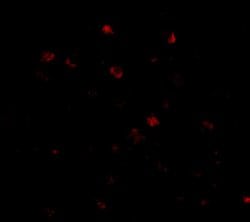 Invitrogen NUP160 Polyclonal Antibody 100 &mu;g; Unconjugated:Antibodies,