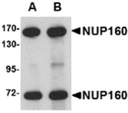 Invitrogen NUP160 Polyclonal Antibody 100 &mu;g; Unconjugated:Antibodies,