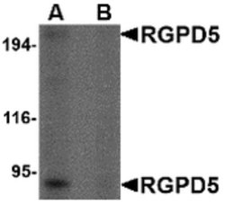 Invitrogen RGPD5 Polyclonal Antibody 100 &mu;g | Buy Online | Invitrogen&trade; | Fisher Scientific