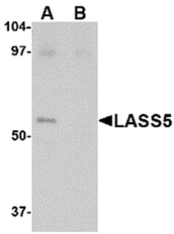 Invitrogen Lass5 Polyclonal Antibody 100 μg; Unconjugated:Antibodies,