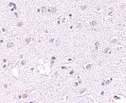 Invitrogen Lass5 Polyclonal Antibody 100 &mu;g; Unconjugated:Antibodies,
