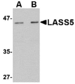 Invitrogen Lass5 Polyclonal Antibody 100 &mu;g; Unconjugated:Antibodies,