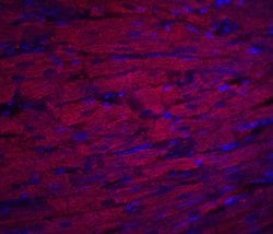 Invitrogen ASAH1 Polyclonal Antibody 100 &mu;g; Unconjugated:Antibodies,