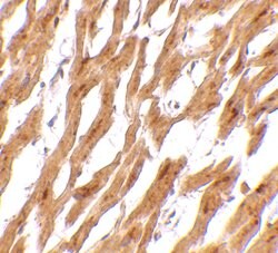 Invitrogen ASAH1 Polyclonal Antibody 100 &mu;g; Unconjugated:Antibodies,