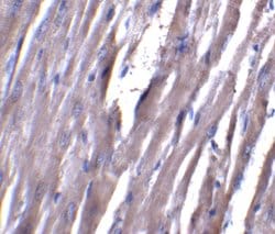 Invitrogen ASAH1 Polyclonal Antibody 100 &mu;g; Unconjugated:Antibodies,