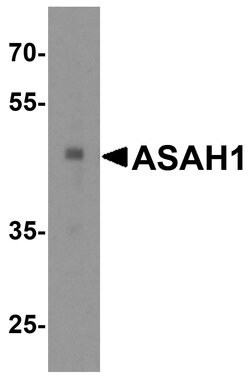 Invitrogen ASAH1 Polyclonal Antibody 100 &mu;g; Unconjugated:Antibodies,