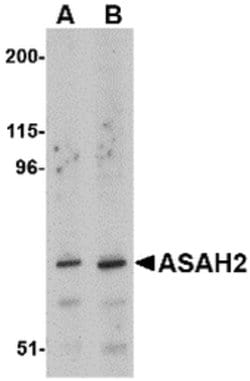 Invitrogen ASAH2 Polyclonal Antibody 100 &mu;g; Unconjugated:Antibodies,